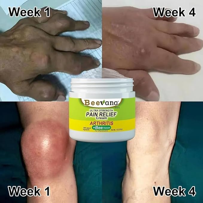 Bee Venom Ultra Strength Pain Relief Cream Pack of 2